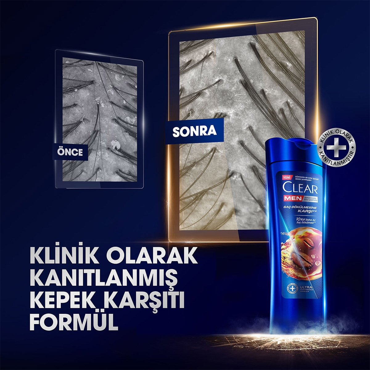 Şampuan Men Saç Dökülmesine Karşı 350 ml