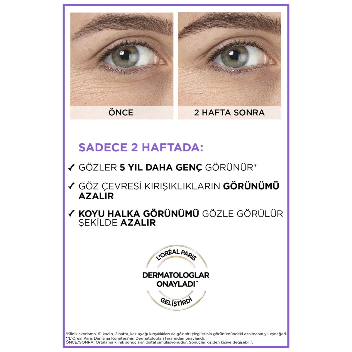 Göz Bakım Serumu Revitalift Filler 20 ml