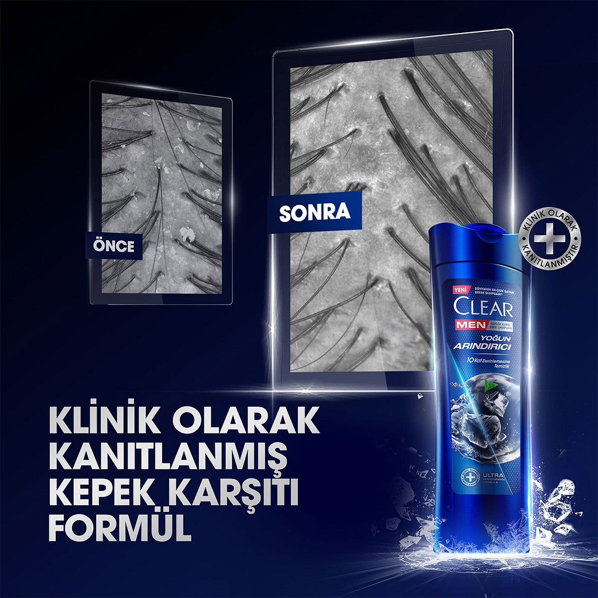 Şampuan Men Yoğun Arındırıcı Kömür 350 ml