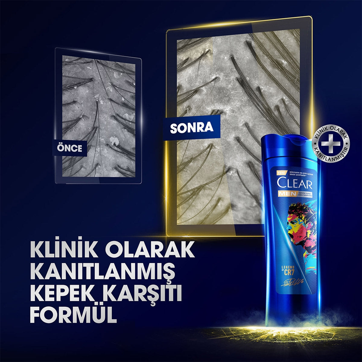 Şampuan Men Ronaldo 350ml