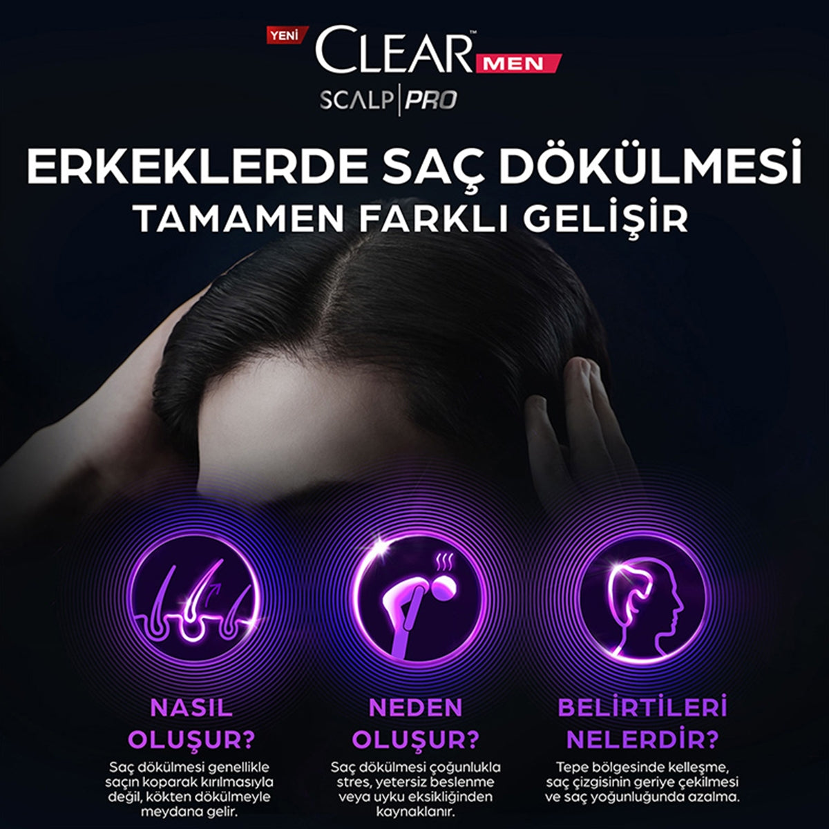 Şampuan Men Scalp Pro Saç Dökülmesine Karşı 300 ml