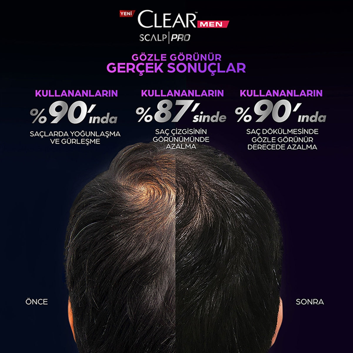 Şampuan Men Scalp Pro Saç Dökülmesine Karşı 300 ml