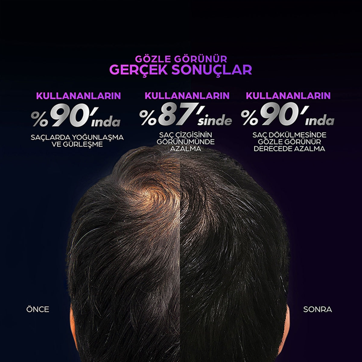 Saç Serumu Men Scalp Pro Saç Dökülmesine Karşı 70 ml