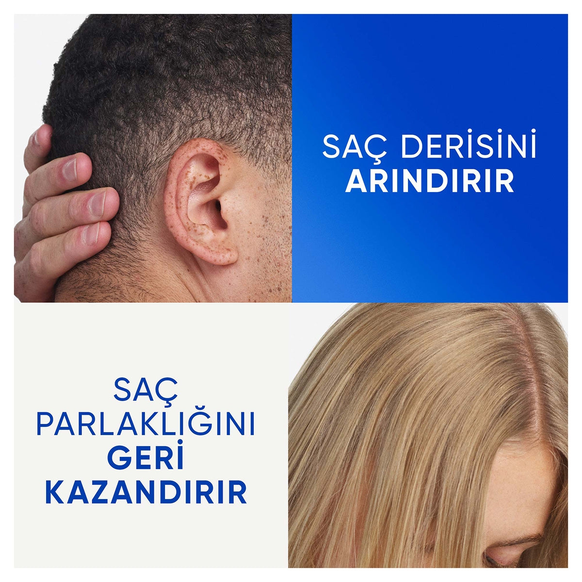 Head&Shoulders Arındırma ve Parlaklık Elma Sirkesi 330Ml