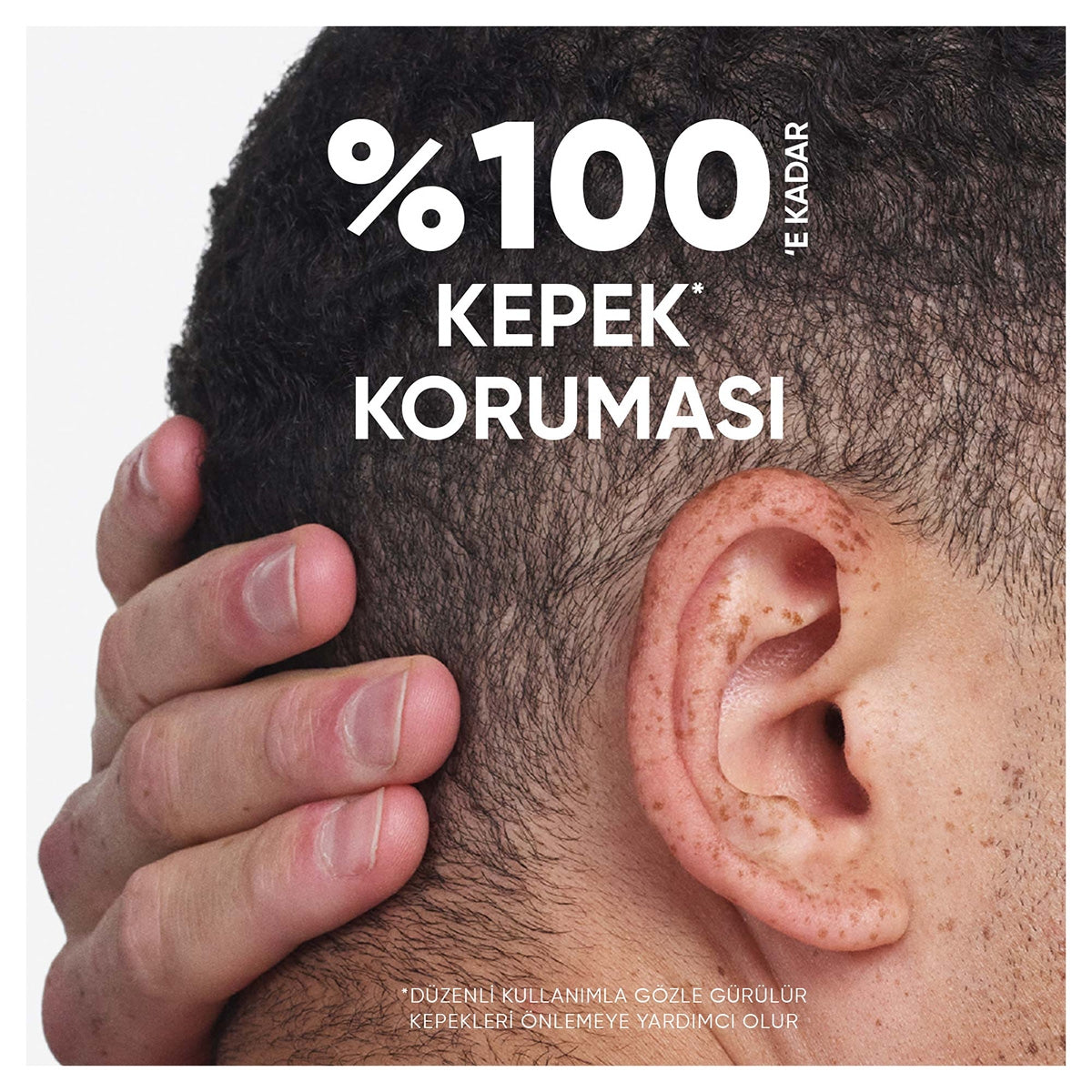 Head&Shoulders Arındırma ve Parlaklık Elma Sirkesi 330Ml