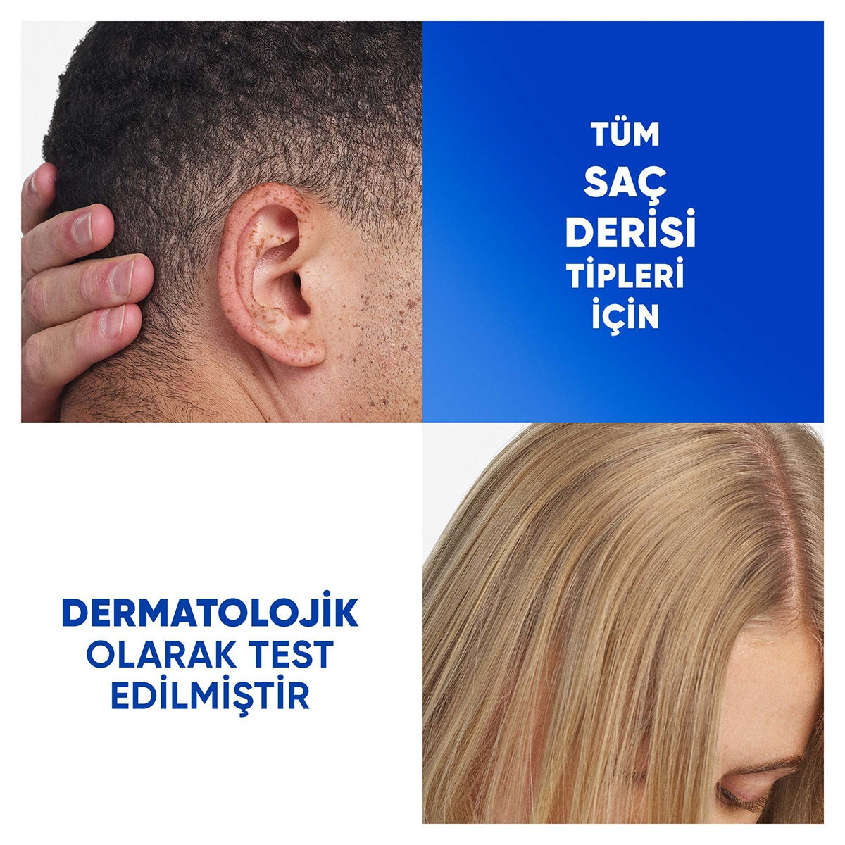 Head&Shoulders Hasas Saç Derisi Bakımı Aloe Vera 330 Ml